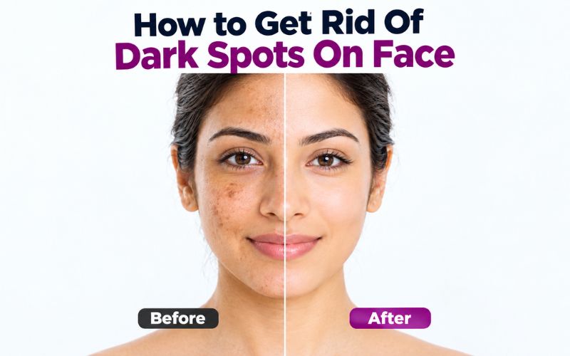 How to Get Rid Of Dark Spots On Face
