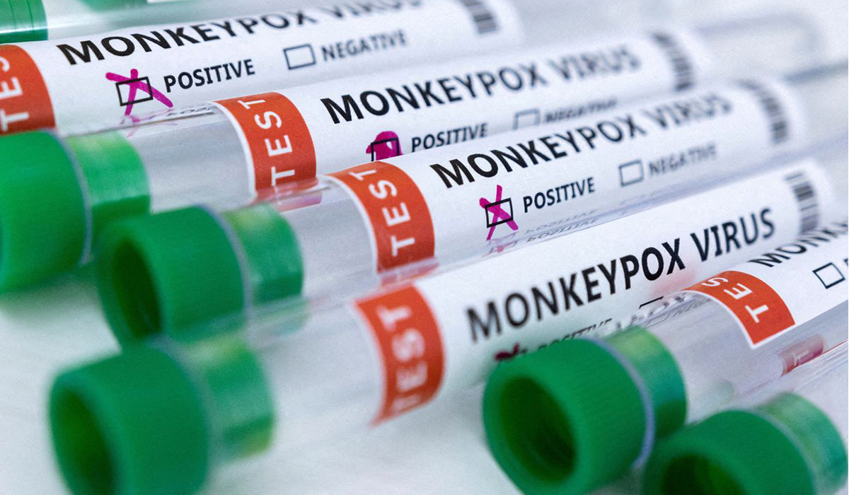 Monkeypox