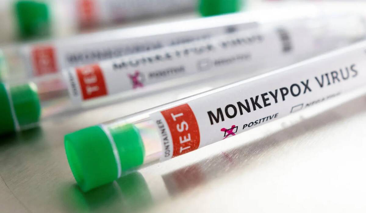 Monkeypox