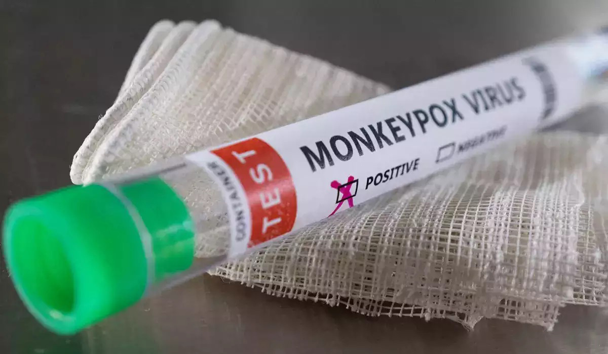 Monkeypox