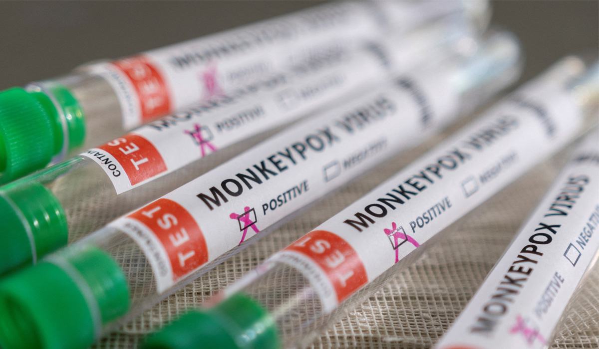 Monkeypox