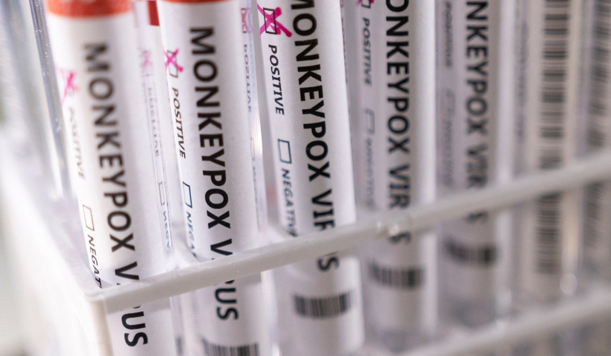 Monkeypox