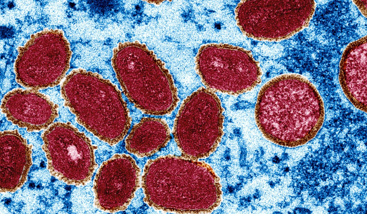 Monkeypox